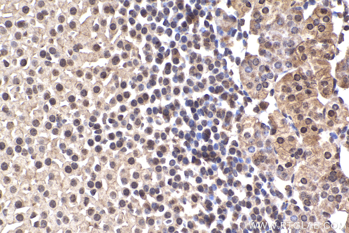 Immunohistochemical analysis of paraffin-embedded mouse adrenal gland tissue slide using KHC2251 (ARL3 IHC Kit).