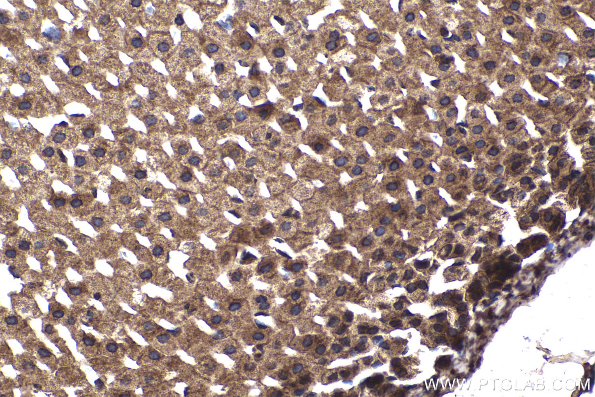 Immunohistochemical analysis of paraffin-embedded rat adrenal gland tissue slide using KHC2251 (ARL3 IHC Kit).