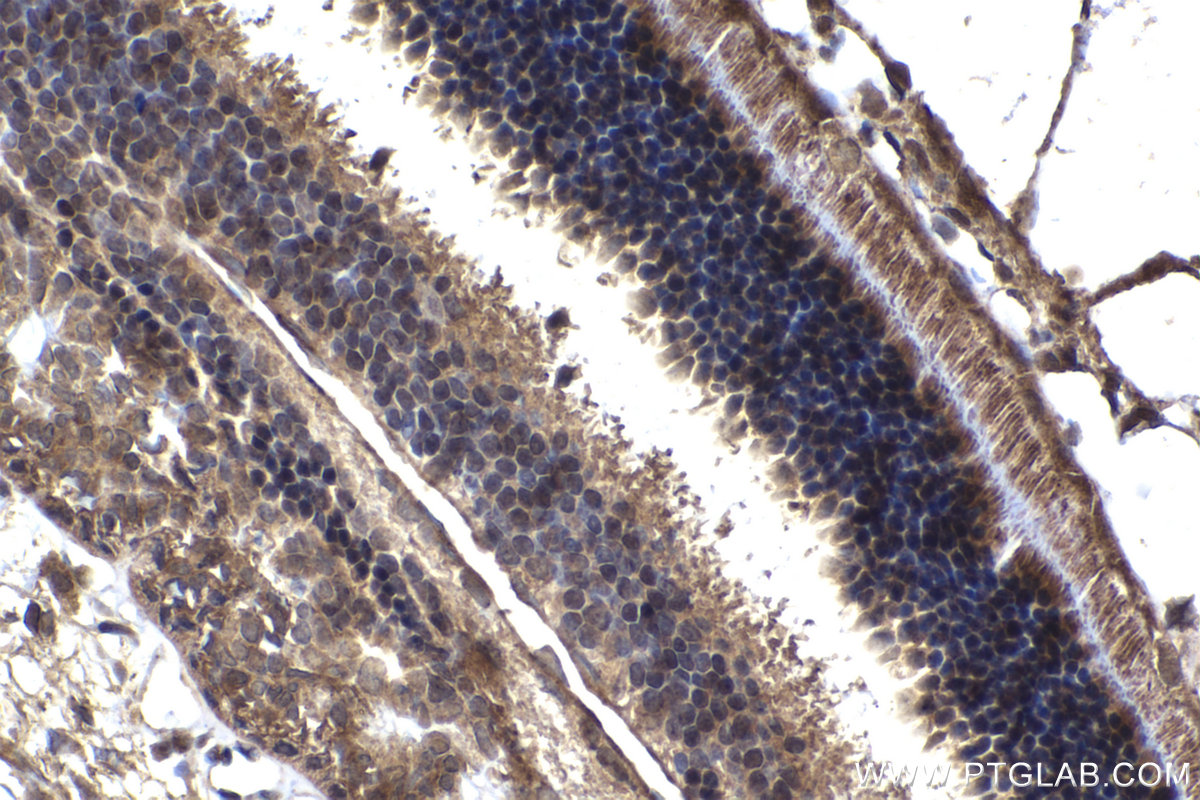 Immunohistochemical analysis of paraffin-embedded rat eye tissue slide using KHC2251 (ARL3 IHC Kit).