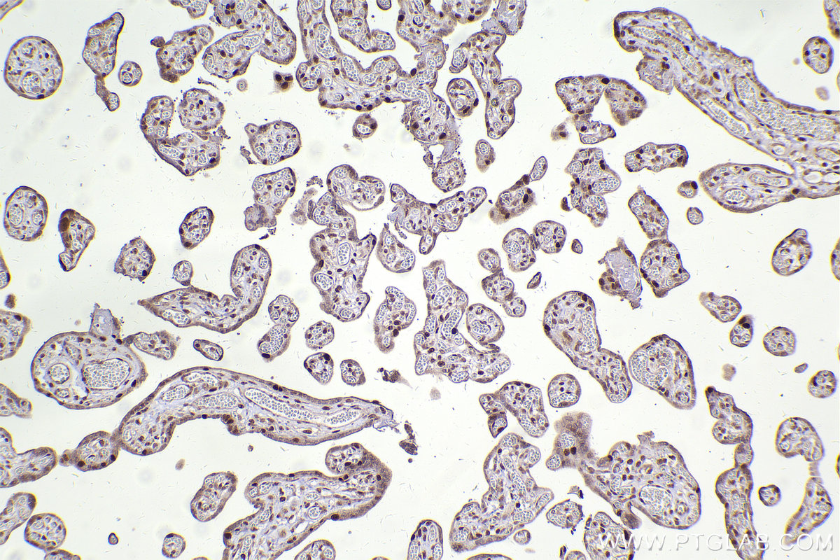 Immunohistochemical analysis of paraffin-embedded human placenta tissue slide using KHC2424 (ATM IHC Kit).