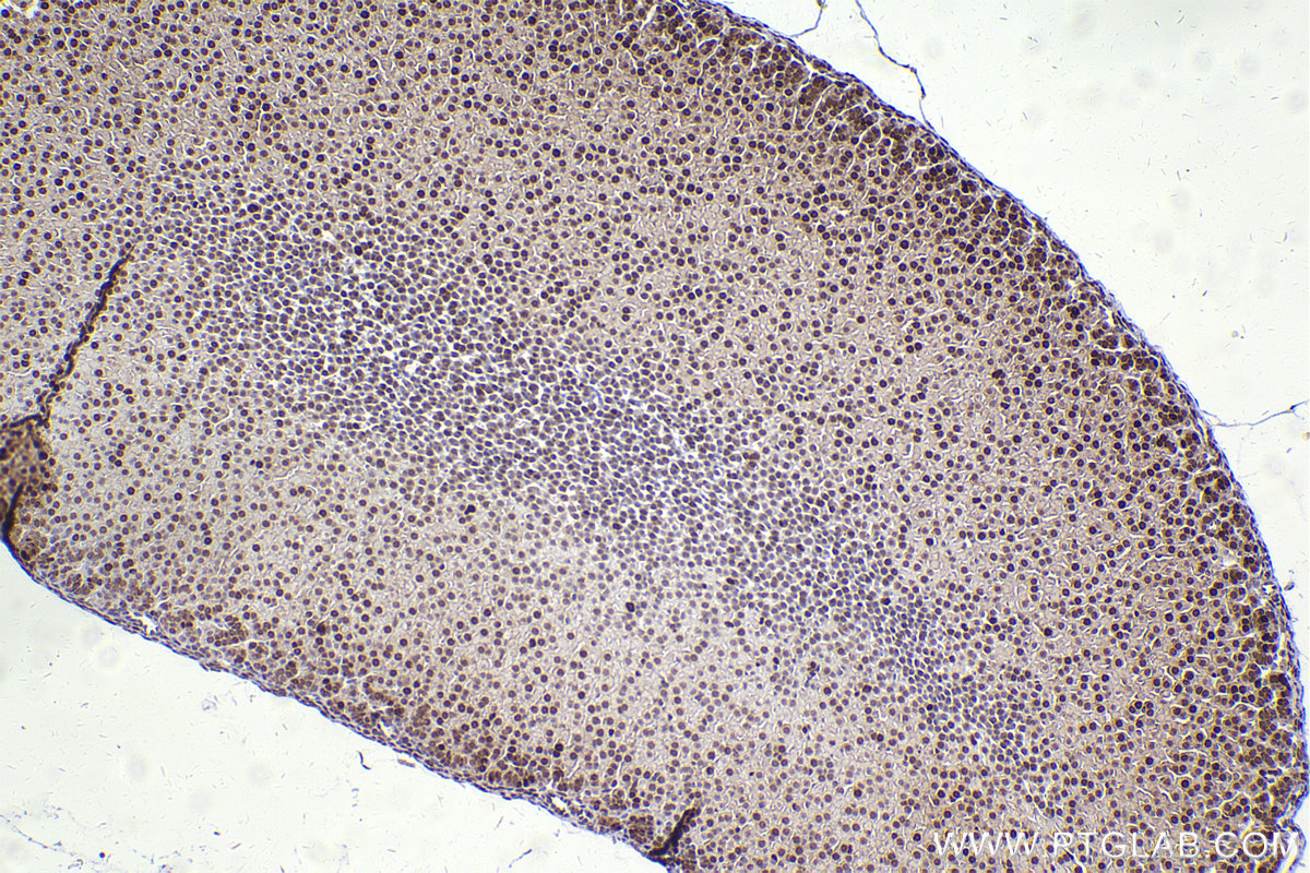 Immunohistochemical analysis of paraffin-embedded mouse adrenal gland tissue slide using KHC2424 (ATM IHC Kit).