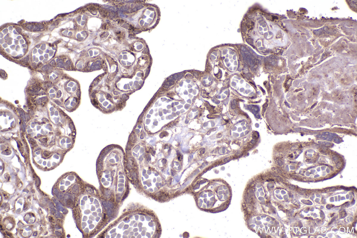 Immunohistochemical analysis of paraffin-embedded human placenta tissue slide using KHC2379 (ATP2C1 IHC Kit).