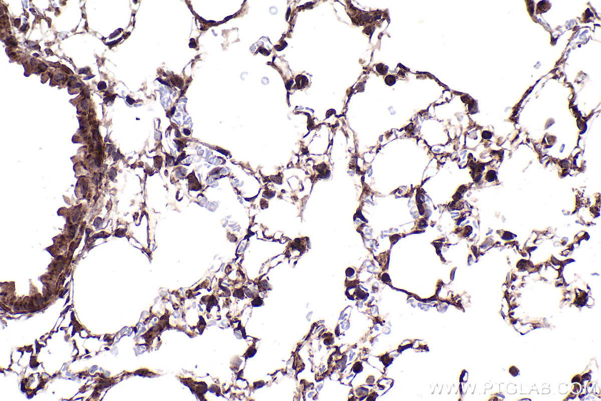 Immunohistochemical analysis of paraffin-embedded mouse lung tissue slide using KHC2379 (ATP2C1 IHC Kit).