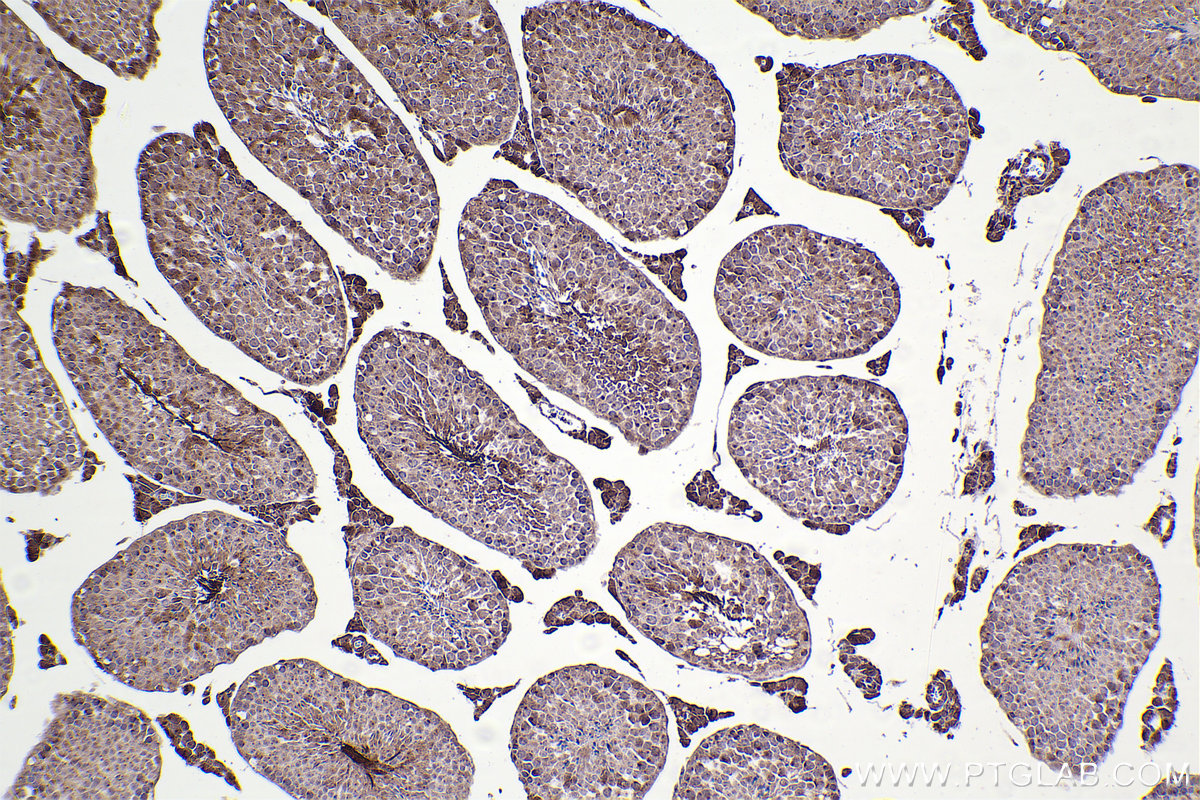 Immunohistochemical analysis of paraffin-embedded mouse testis tissue slide using KHC2379 (ATP2C1 IHC Kit).