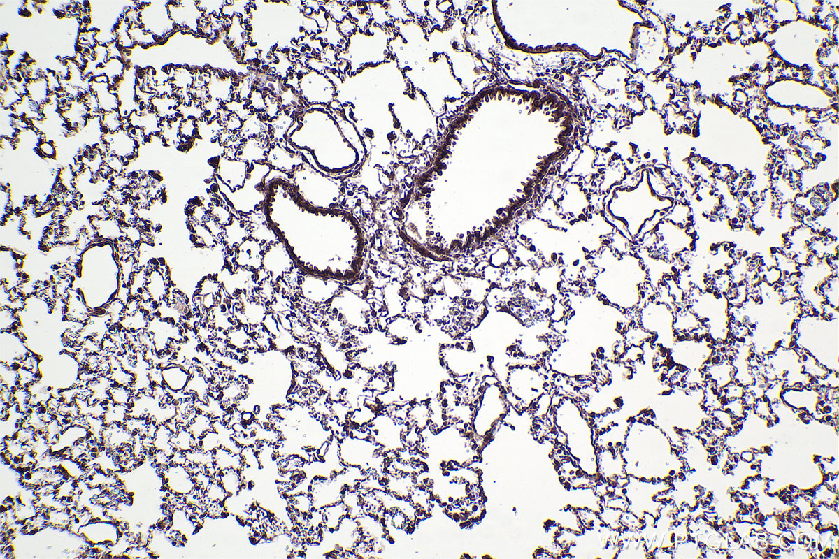 Immunohistochemical analysis of paraffin-embedded rat lung tissue slide using KHC2379 (ATP2C1 IHC Kit).