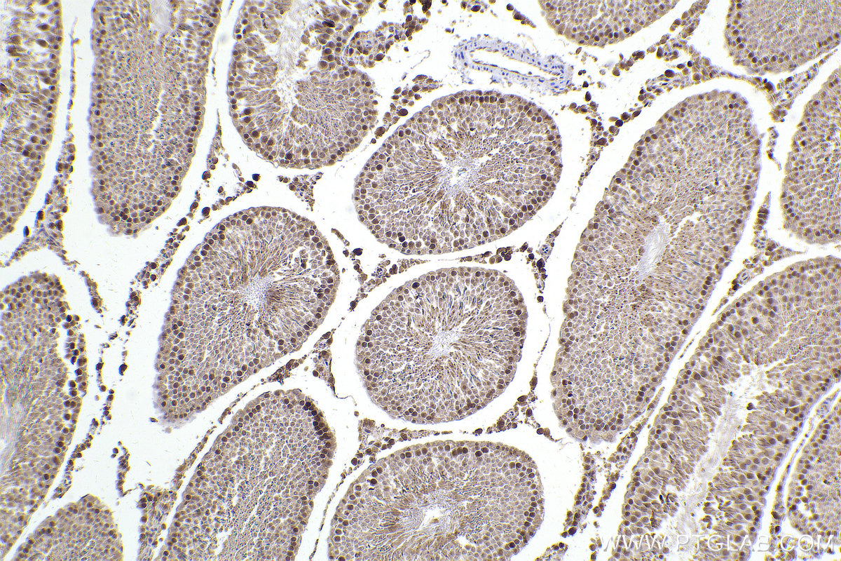 Immunohistochemical analysis of paraffin-embedded rat testis tissue slide using KHC2431 (ATR IHC Kit).