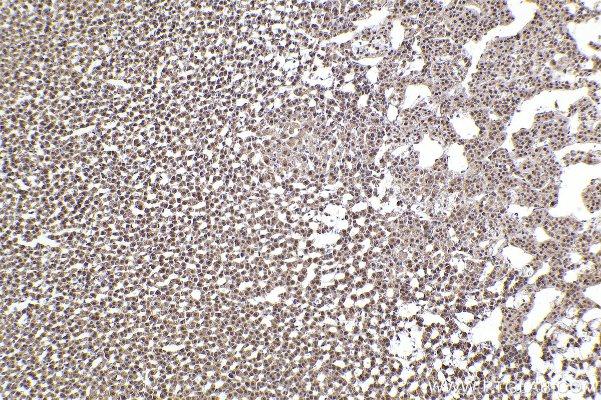 Immunohistochemical analysis of paraffin-embedded rat adrenal gland tissue slide using KHC2431 (ATR IHC Kit).