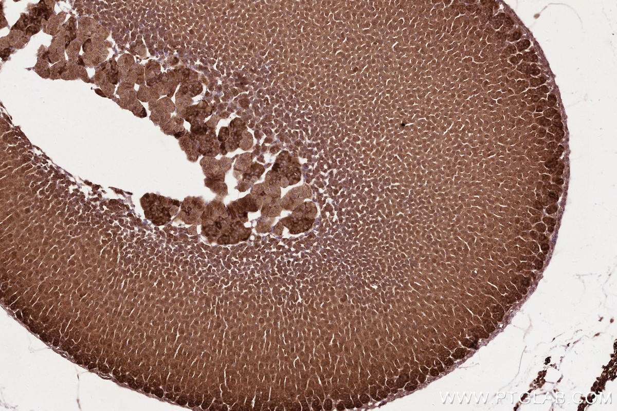 Immunohistochemical analysis of paraffin-embedded mouse adrenal gland tissue slide using KHC2596 (ATRAID/C2orf28 IHC Kit).