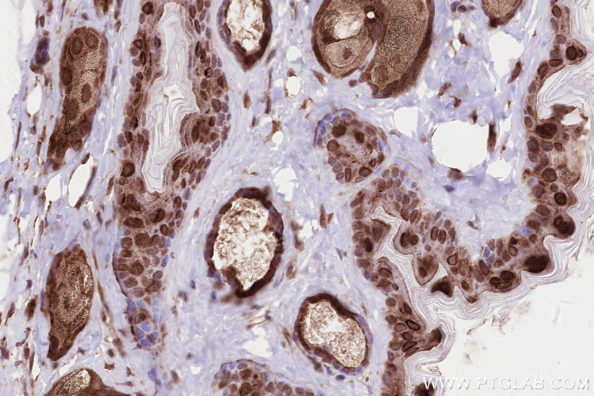 Immunohistochemical analysis of paraffin-embedded mouse skin tissue slide using KHC2596 (ATRAID/C2orf28 IHC Kit).