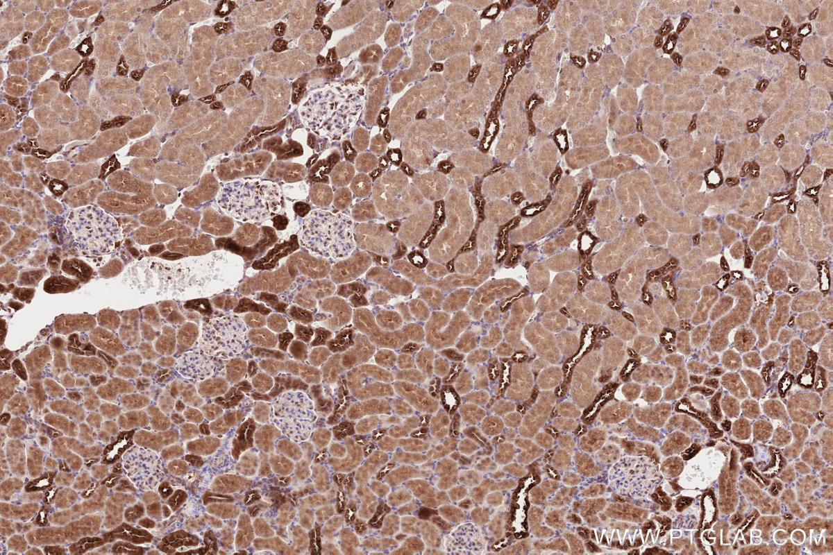 Immunohistochemical analysis of paraffin-embedded rat kidney tissue slide using KHC2596 (ATRAID/C2orf28 IHC Kit).