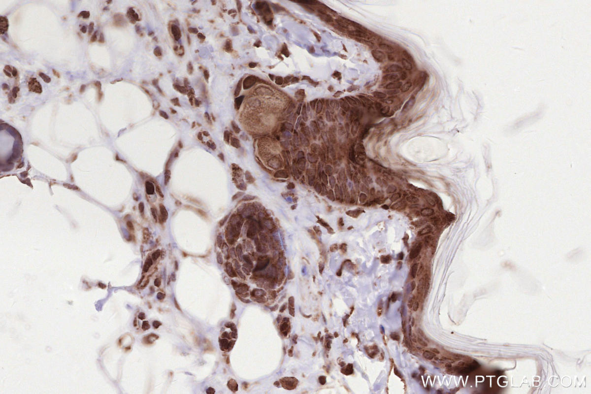 Immunohistochemical analysis of paraffin-embedded rat skin tissue slide using KHC2596 (ATRAID/C2orf28 IHC Kit).