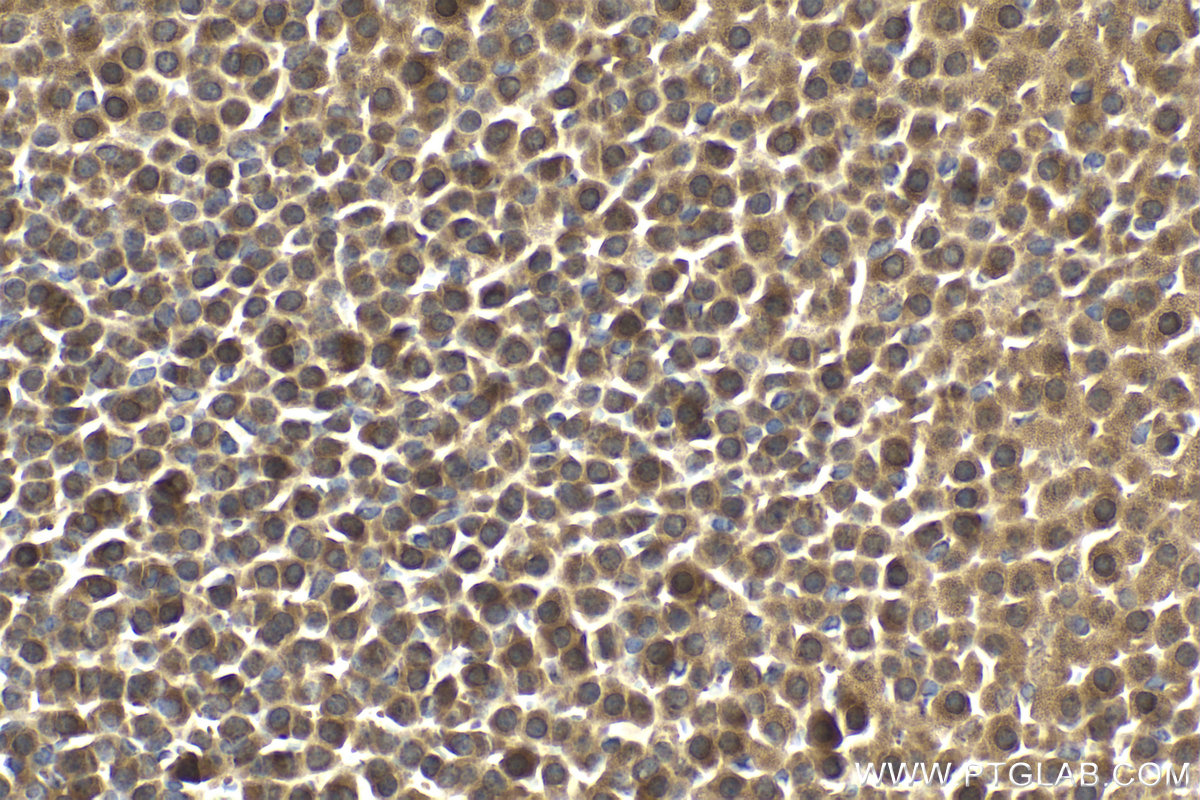 Immunohistochemical analysis of paraffin-embedded mouse adrenal gland tissue slide using KHC2148 (BAG2 IHC Kit).