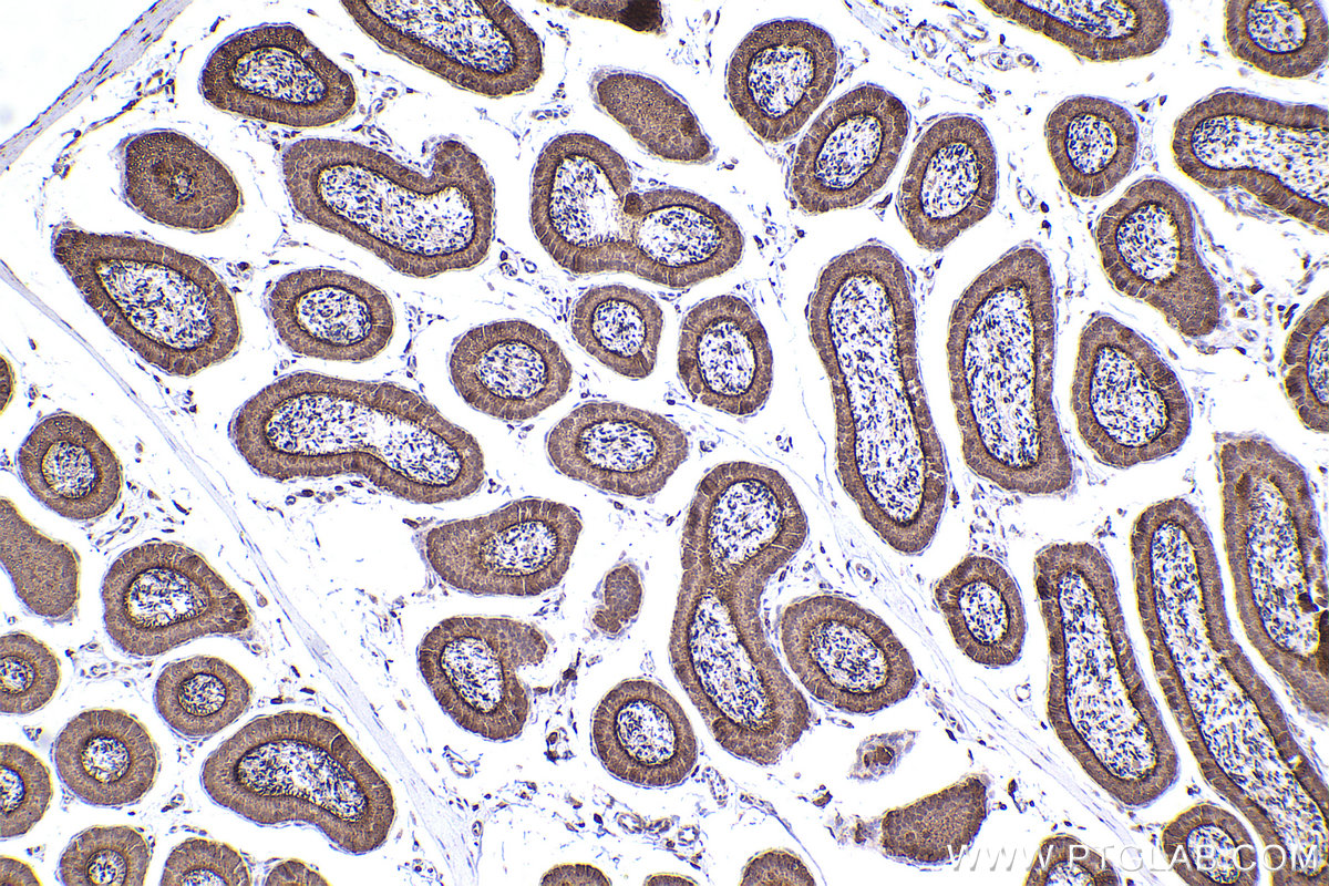 Immunohistochemical analysis of paraffin-embedded mouse epididymis tissue slide using KHC2369 (BASP1 IHC Kit).