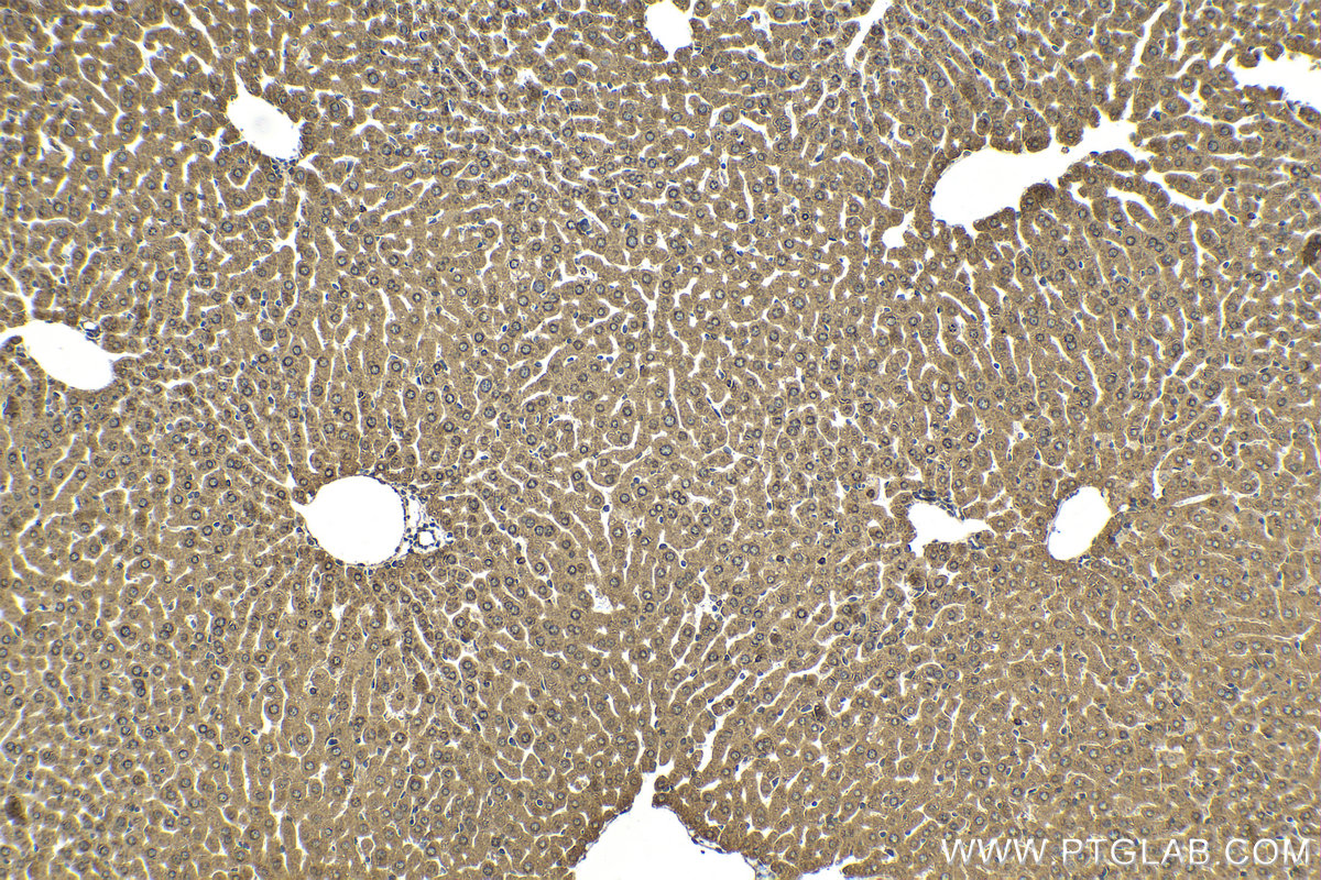 Immunohistochemical analysis of paraffin-embedded mouse liver tissue slide using KHC2058 (BCKDK IHC Kit).