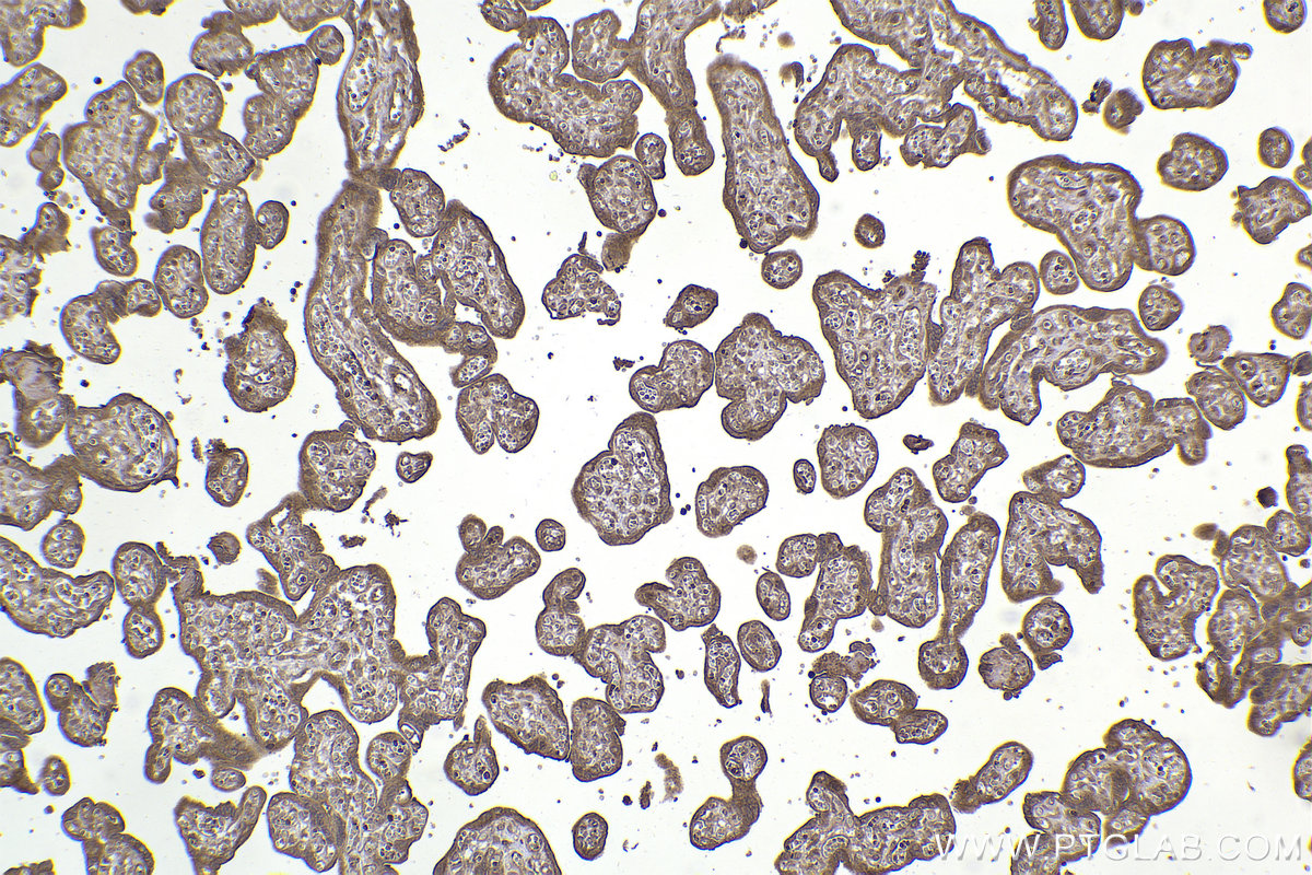 Immunohistochemical analysis of paraffin-embedded human placenta tissue slide using KHC2181 (BCR IHC Kit).