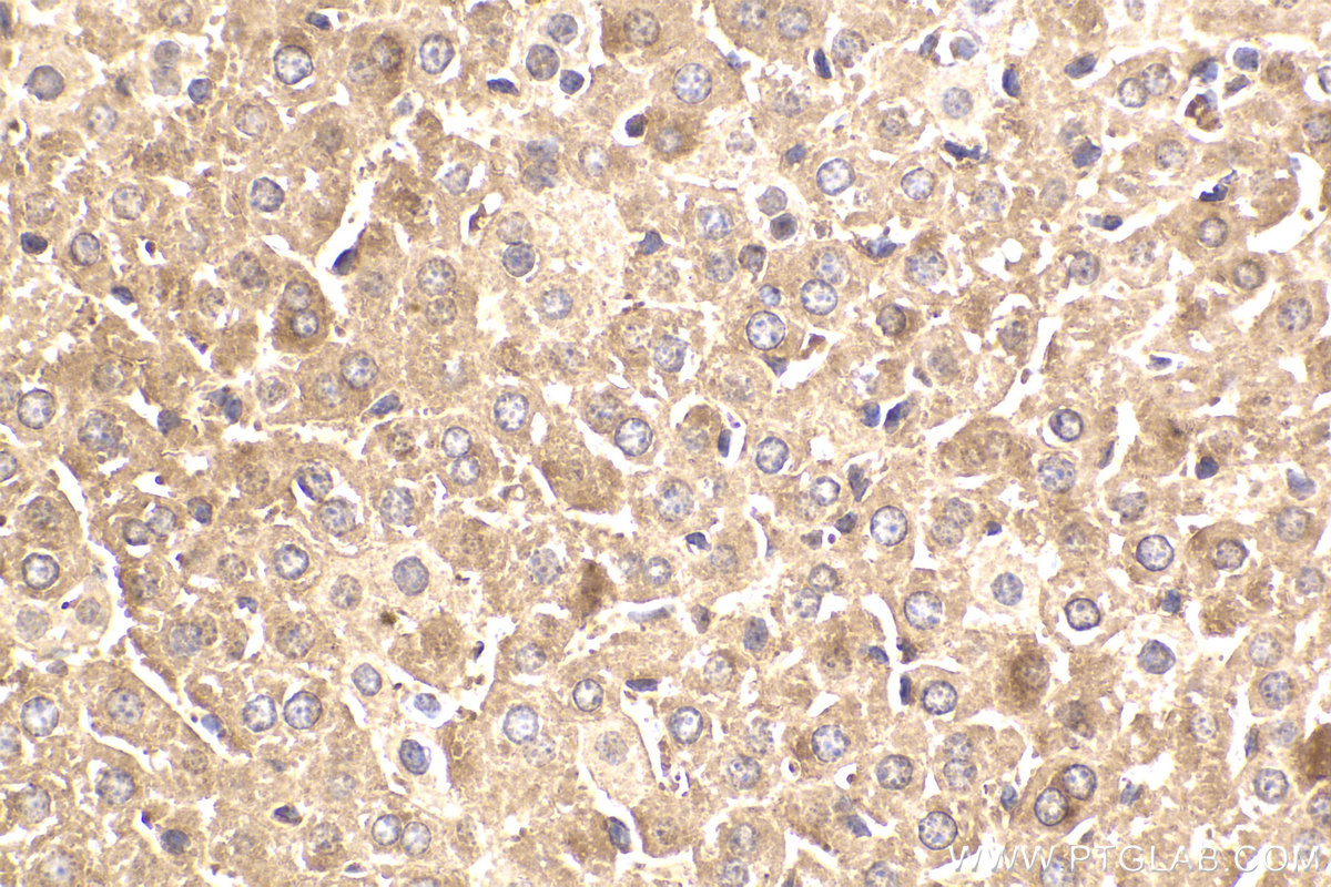 Immunohistochemical analysis of paraffin-embedded mouse liver tissue slide using KHC2181 (BCR IHC Kit).
