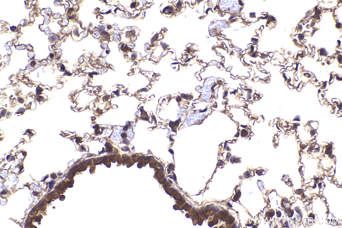 Immunohistochemical analysis of paraffin-embedded mouse lung tissue slide using KHC2181 (BCR IHC Kit).