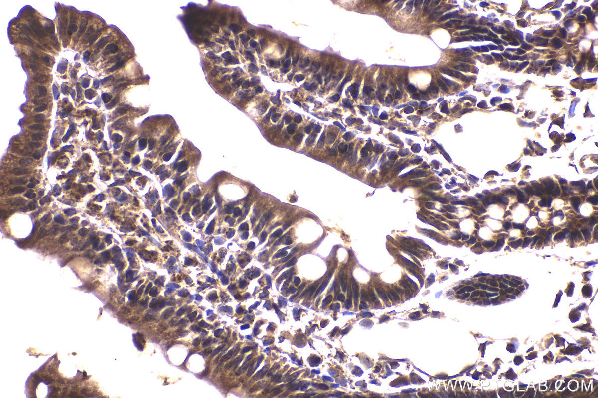 Immunohistochemical analysis of paraffin-embedded rat small intestine tissue slide using KHC2181 (BCR IHC Kit).