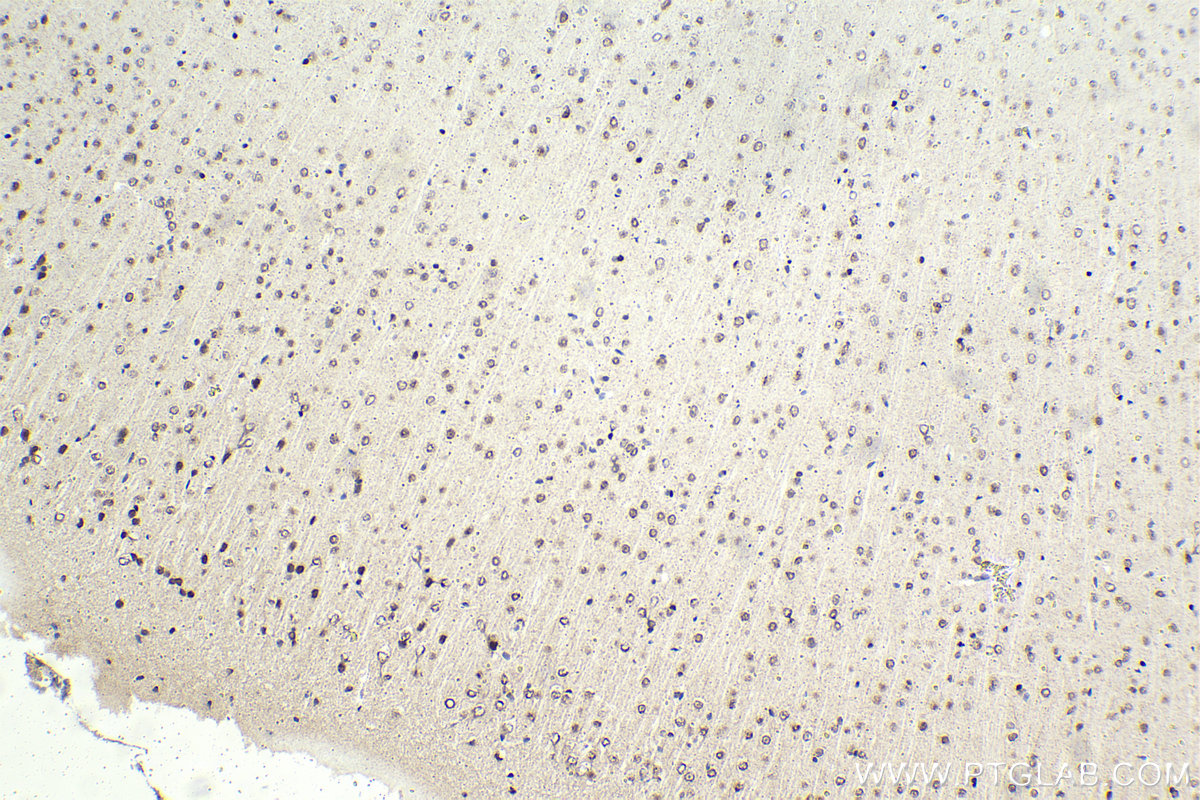 Immunohistochemical analysis of paraffin-embedded mouse brain tissue slide using KHC1926 (BHLHE41 IHC Kit).