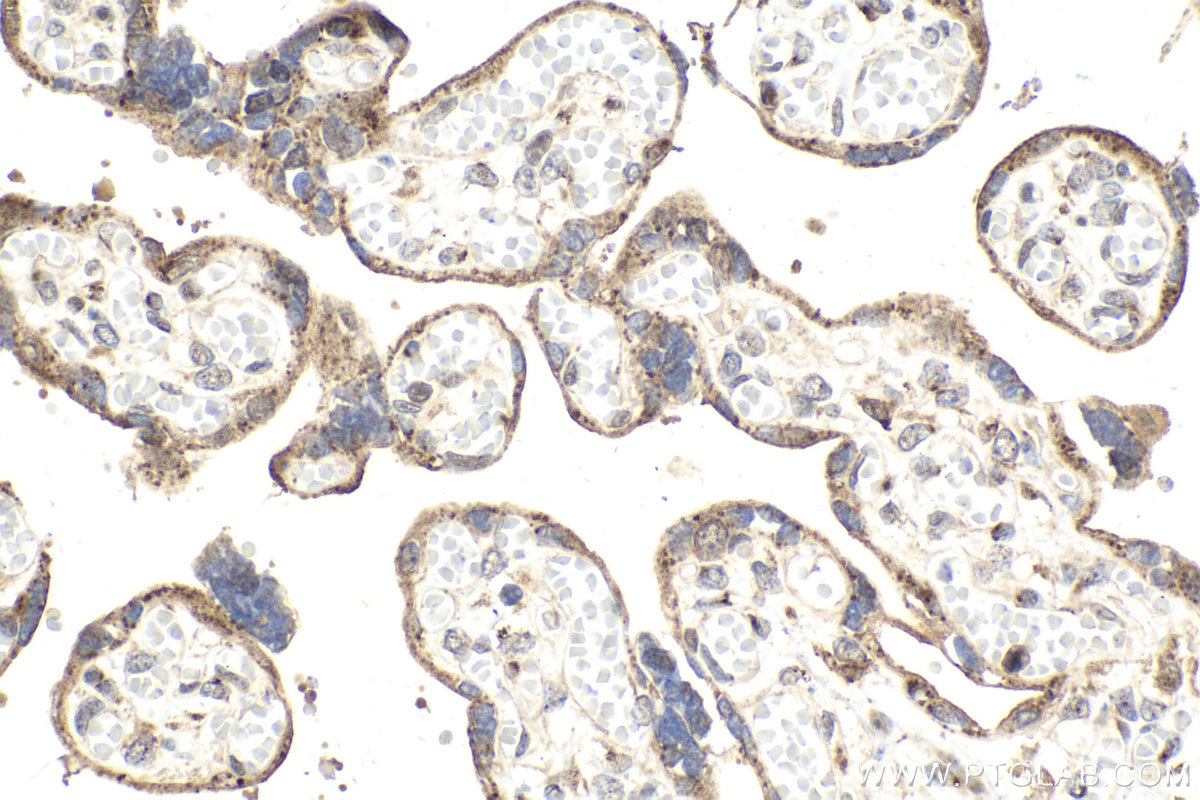 Immunohistochemical analysis of paraffin-embedded human placenta tissue slide using KHC2150 (BMP15 IHC Kit).