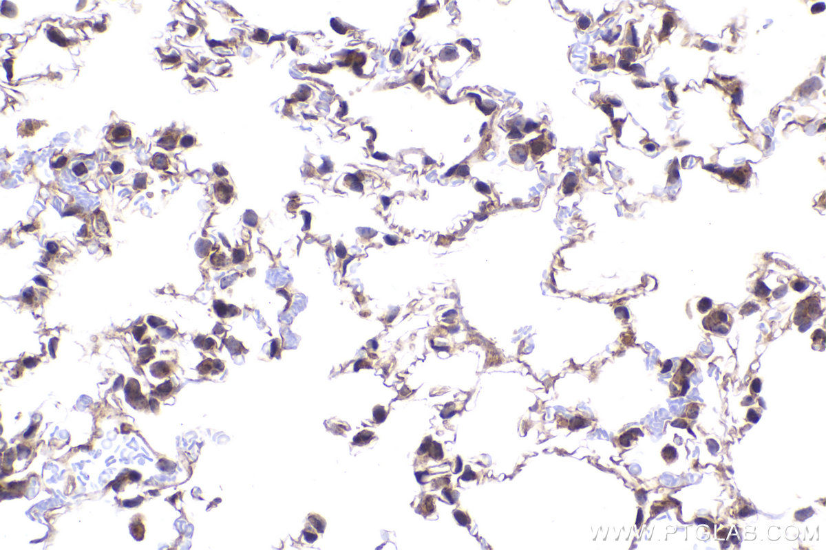 Immunohistochemical analysis of paraffin-embedded mouse lung tissue slide using KHC2183 (BMP4 IHC Kit).