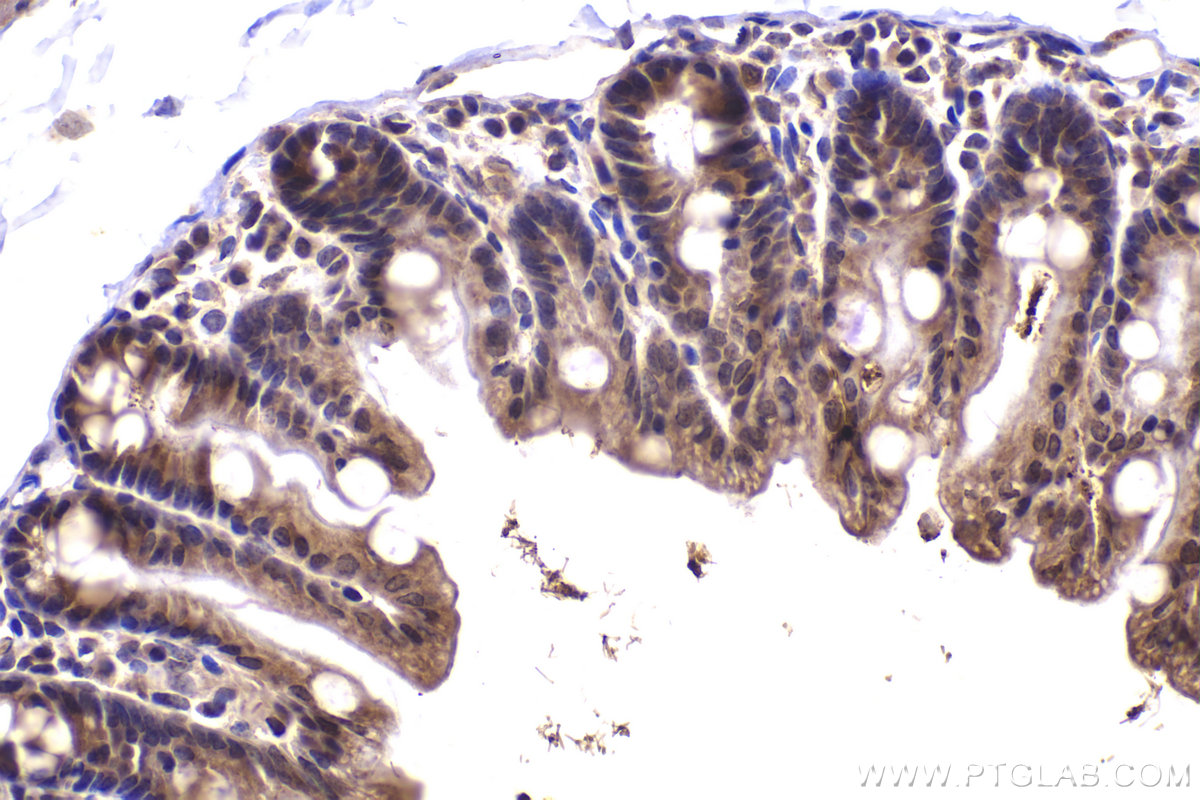 Immunohistochemical analysis of paraffin-embedded mouse small intestine tissue slide using KHC2183 (BMP4 IHC Kit).