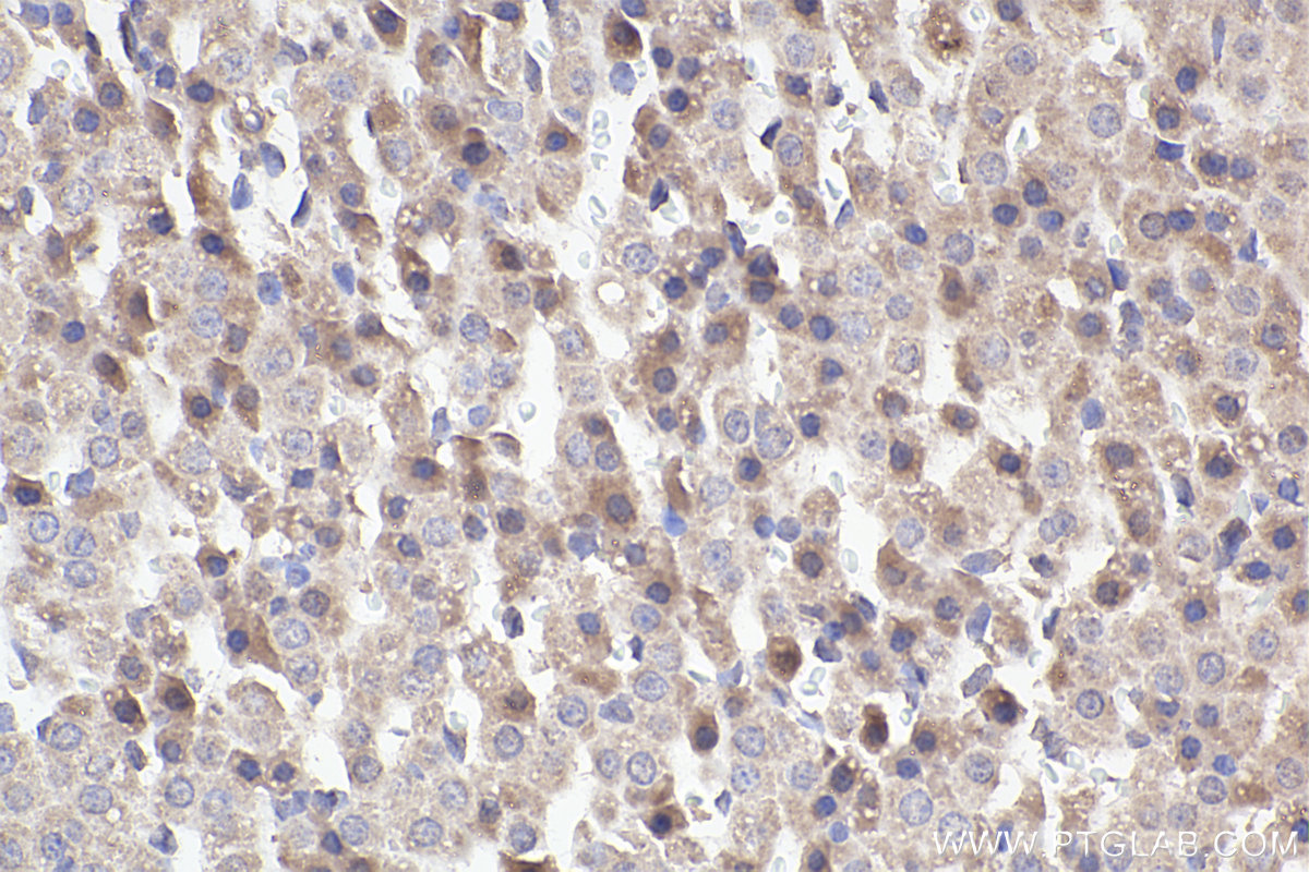 Immunohistochemical analysis of paraffin-embedded rat adrenal gland tissue slide using KHC2381 (BORG5/CDC42EP1 IHC Kit).