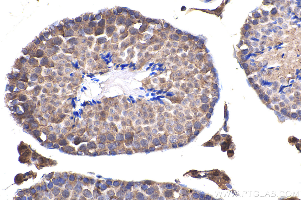 Immunohistochemical analysis of paraffin-embedded mouse testis tissue slide using KHC2381 (BORG5/CDC42EP1 IHC Kit).