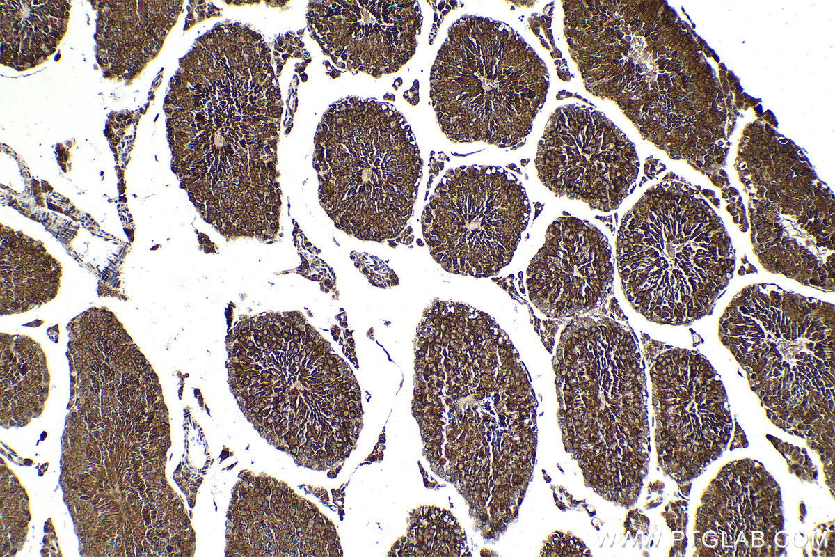 Immunohistochemical analysis of paraffin-embedded mouse testis tissue slide using KHC2099 (BUB1B IHC Kit).