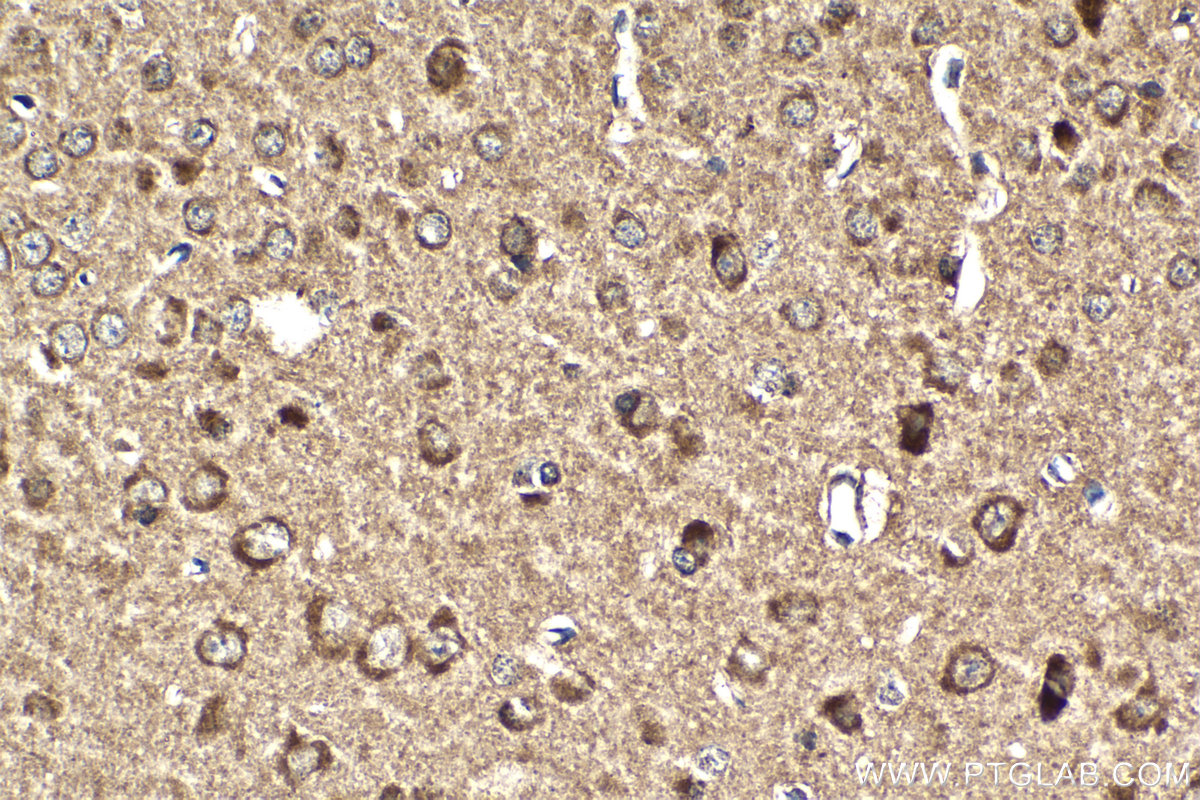 Immunohistochemical analysis of paraffin-embedded mouse brain tissue slide using KHC2099 (BUB1B IHC Kit).