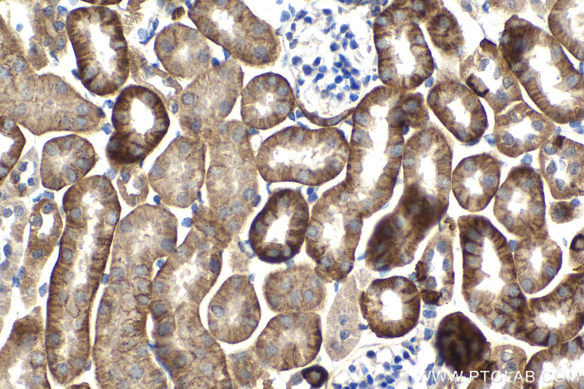 Immunohistochemical analysis of paraffin-embedded mouse kidney tissue slide using KHC2088 (CA12 IHC Kit).