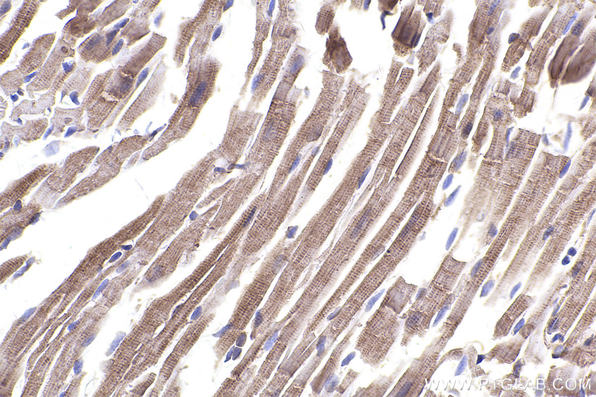 Immunohistochemical analysis of paraffin-embedded mouse heart tissue slide using KHC2433 (CAMK2D IHC Kit).