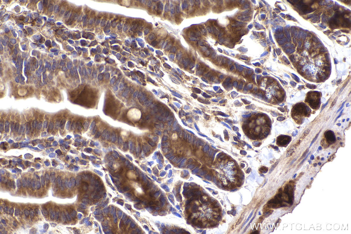 Immunohistochemical analysis of paraffin-embedded mouse small intestine tissue slide using KHC2433 (CAMK2D IHC Kit).