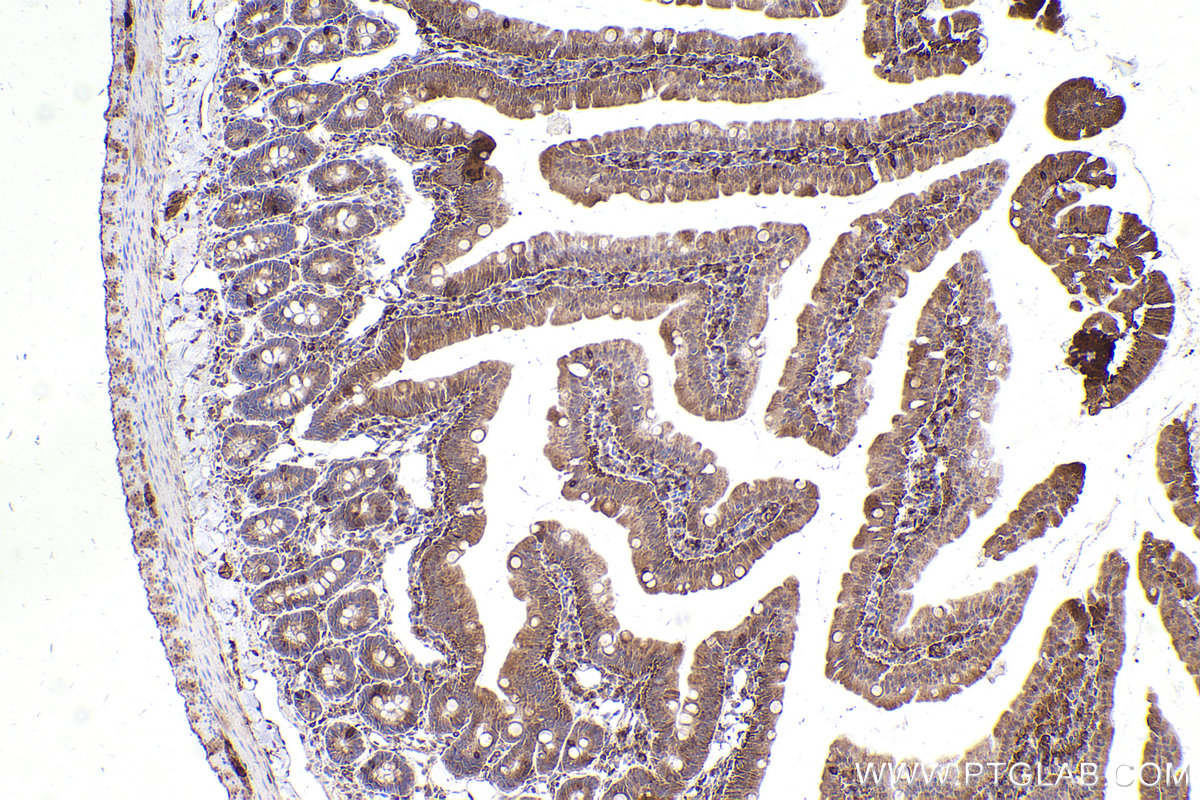 Immunohistochemical analysis of paraffin-embedded rat small intestine tissue slide using KHC2433 (CAMK2D IHC Kit).