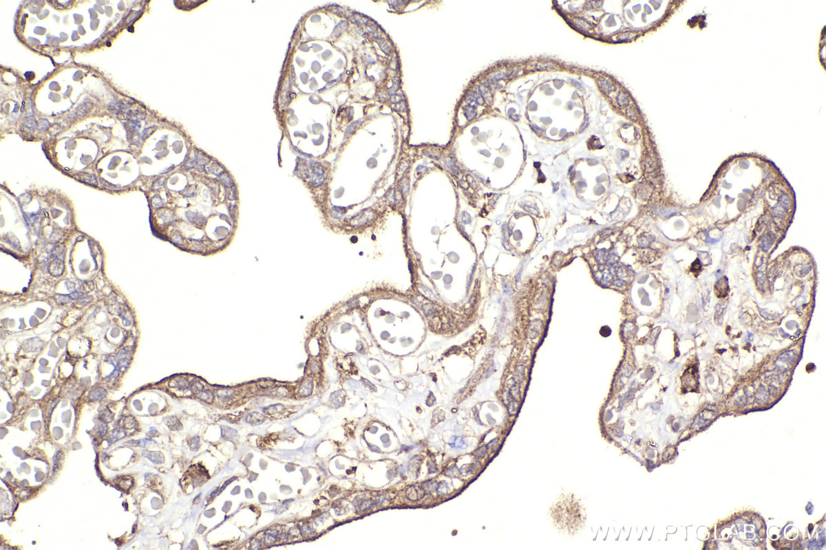 Immunohistochemical analysis of paraffin-embedded human placenta tissue slide using KHC2313 (CAPZA1 IHC Kit).