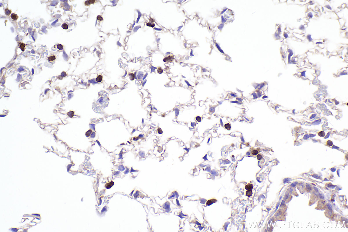 Immunohistochemical analysis of paraffin-embedded mouse lung tissue slide using KHC2313 (CAPZA1 IHC Kit).