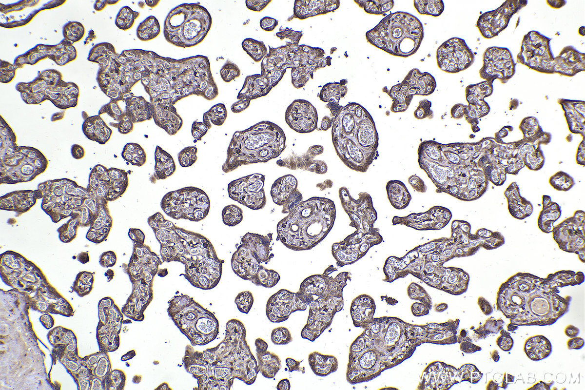 Immunohistochemical analysis of paraffin-embedded human placenta tissue slide using KHC2280 (CAPZA2 IHC Kit).