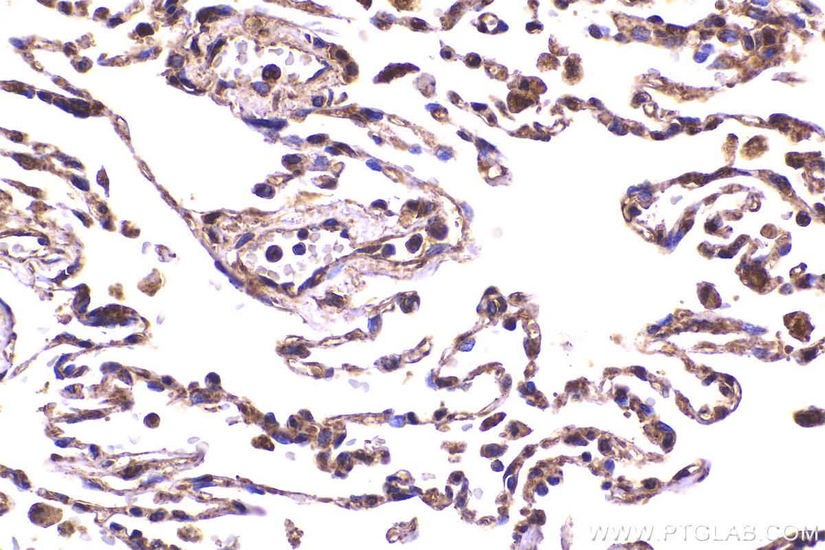 Immunohistochemical analysis of paraffin-embedded human lung tissue slide using KHC2280 (CAPZA2 IHC Kit).