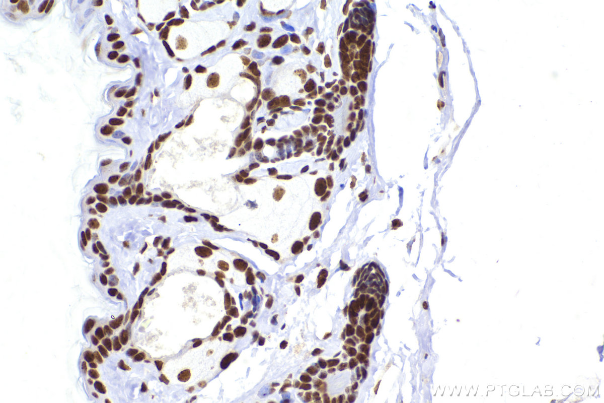 Immunohistochemical analysis of paraffin-embedded mouse skin tissue slide using KHC2421 (CBX3 IHC Kit).