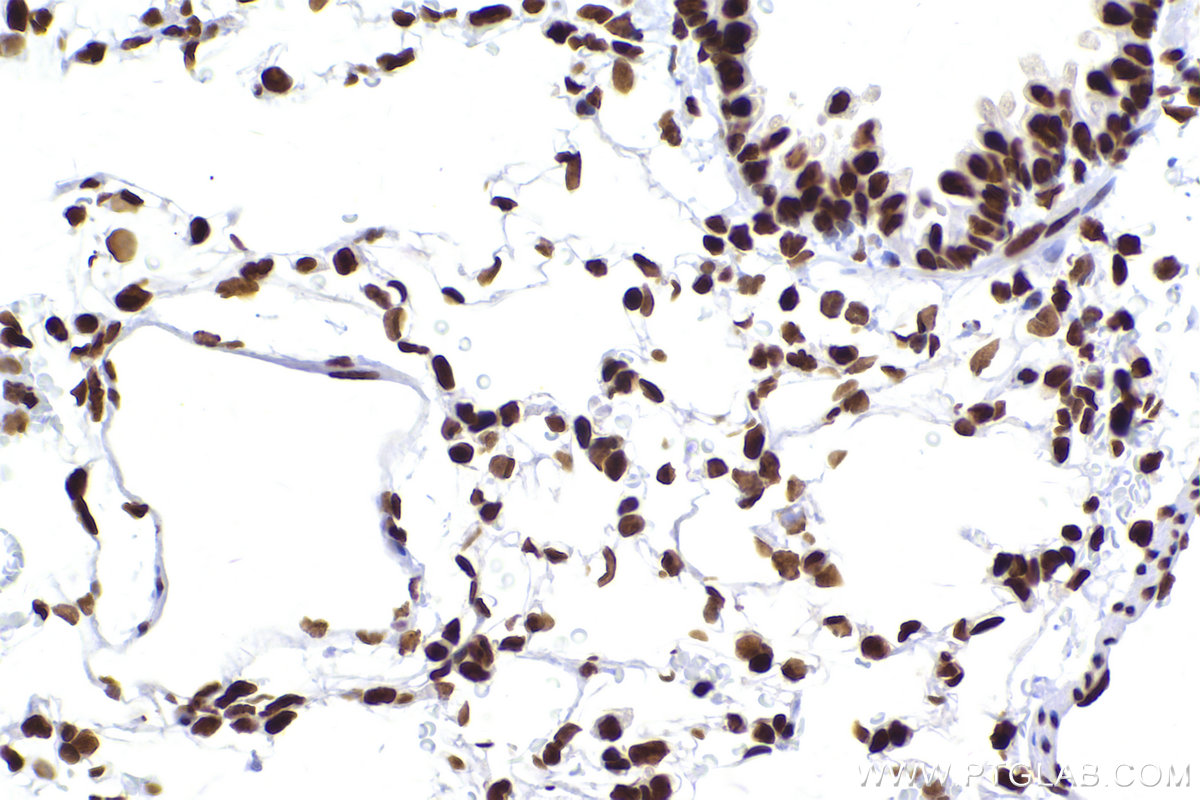 Immunohistochemical analysis of paraffin-embedded rat lung tissue slide using KHC2421 (CBX3 IHC Kit).