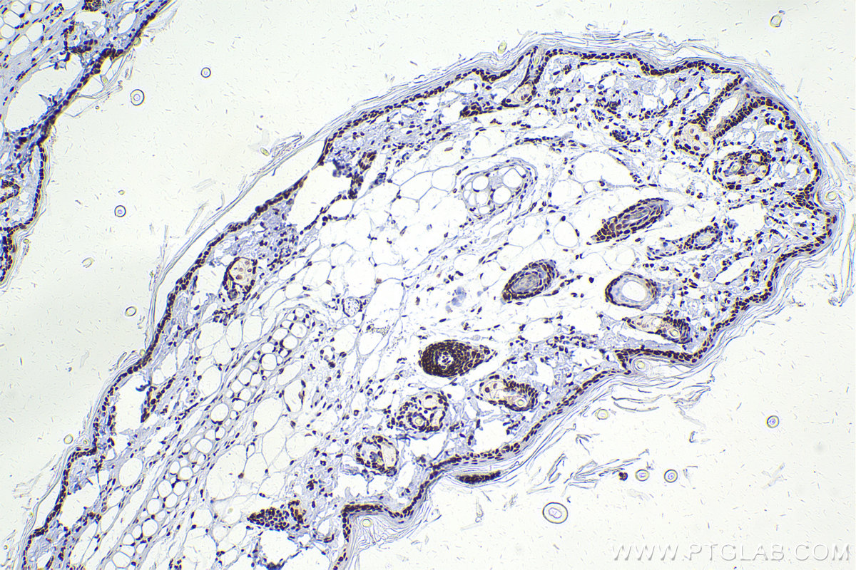 Immunohistochemical analysis of paraffin-embedded rat skin tissue slide using KHC2421 (CBX3 IHC Kit).