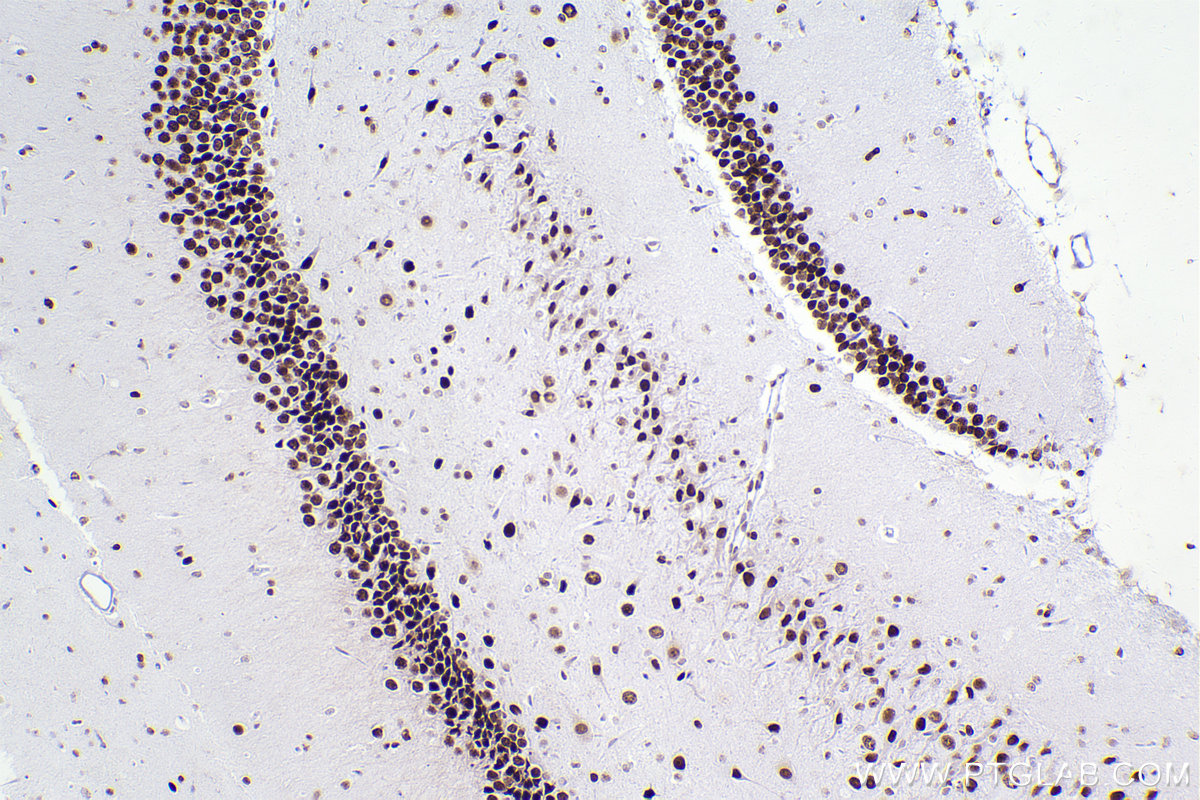 Immunohistochemical analysis of paraffin-embedded rat brain tissue slide using KHC2266 (CBX5 IHC Kit).