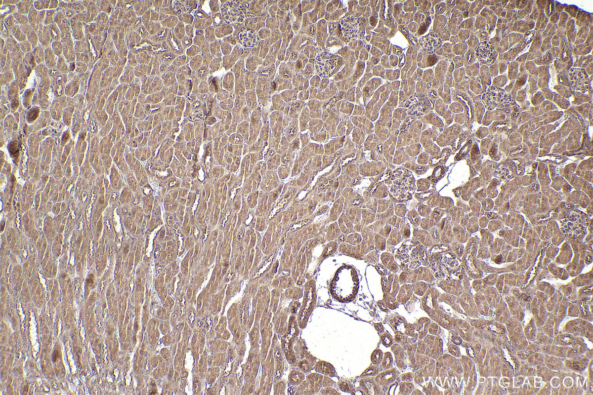 Immunohistochemical analysis of paraffin-embedded mouse kidney tissue slide using KHC2538 (CCDC93 IHC Kit).