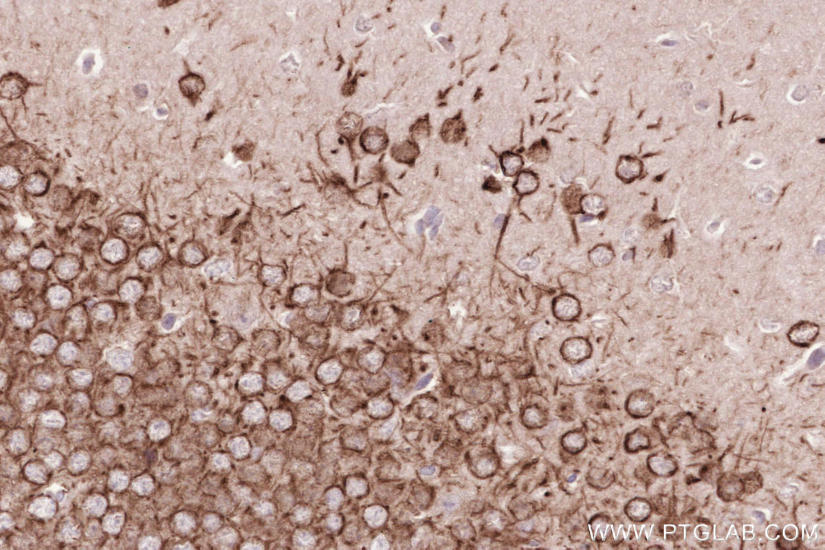 Immunohistochemical analysis of paraffin-embedded mouse brain tissue slide using KHC2581 (CCSAP IHC Kit).