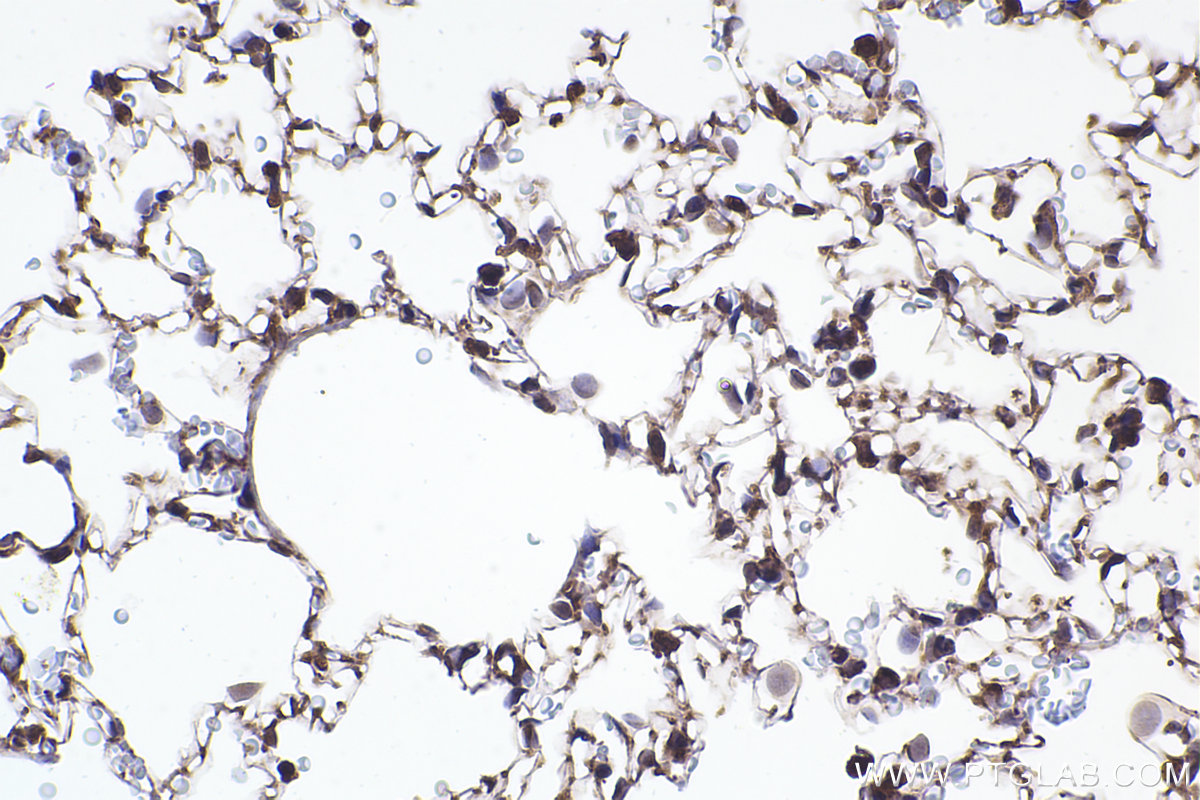 Immunohistochemical analysis of paraffin-embedded rat lung tissue slide using KHC2365 (CCT2 IHC Kit).