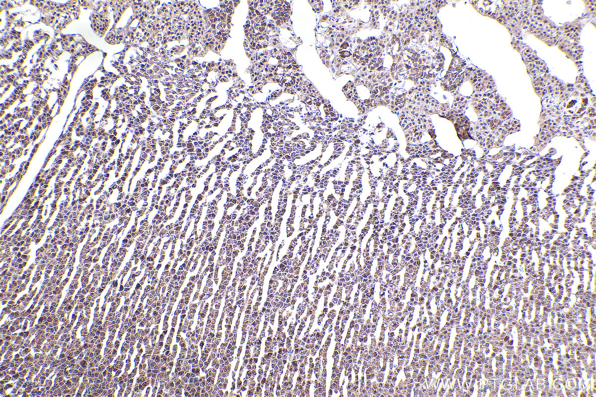 Immunohistochemical analysis of paraffin-embedded rat adrenal gland tissue slide using KHC2365 (CCT2 IHC Kit).