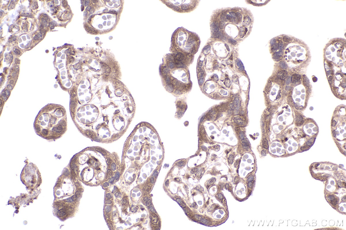 Immunohistochemical analysis of paraffin-embedded human placenta tissue slide using KHC2365 (CCT2 IHC Kit).