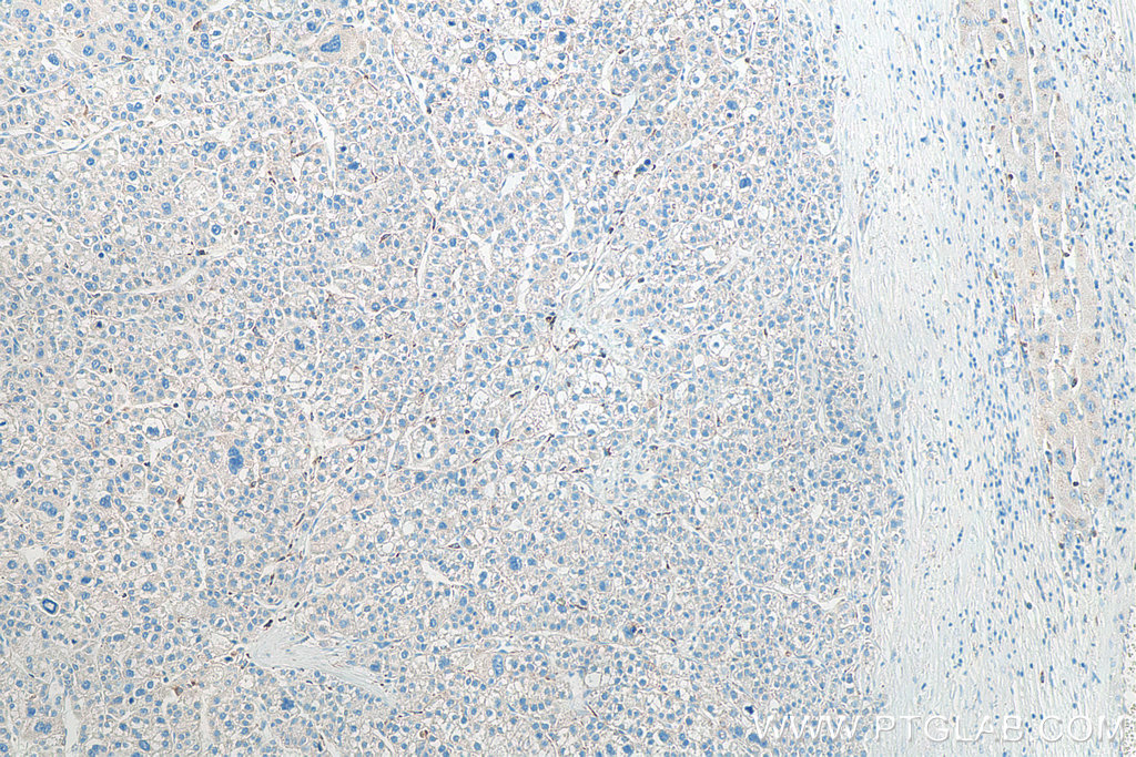 IHCeasy CD11B Ready-To-Use IHC Kit KHC0027 | Proteintech