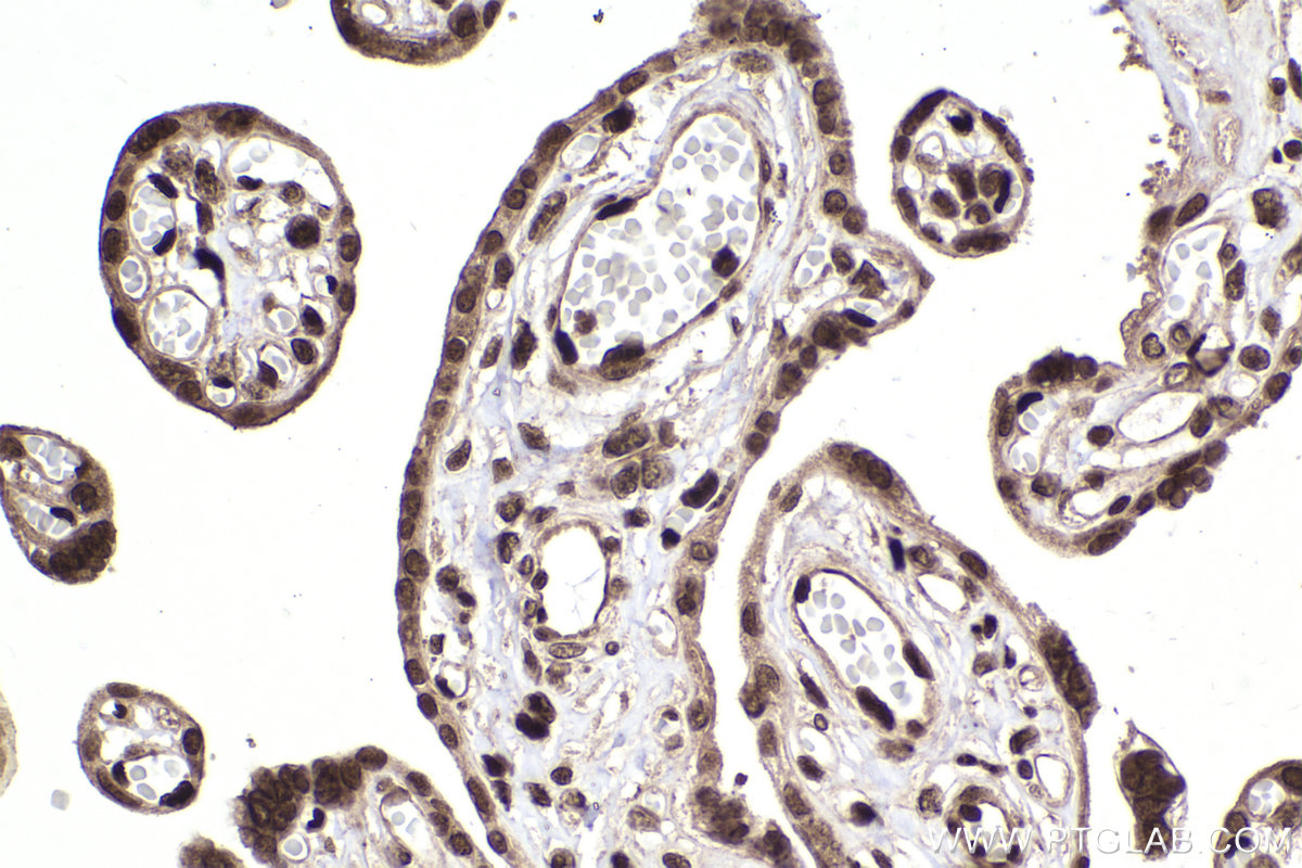 Immunohistochemical analysis of paraffin-embedded human placenta tissue slide using KHC2227 (CDC27 IHC Kit).