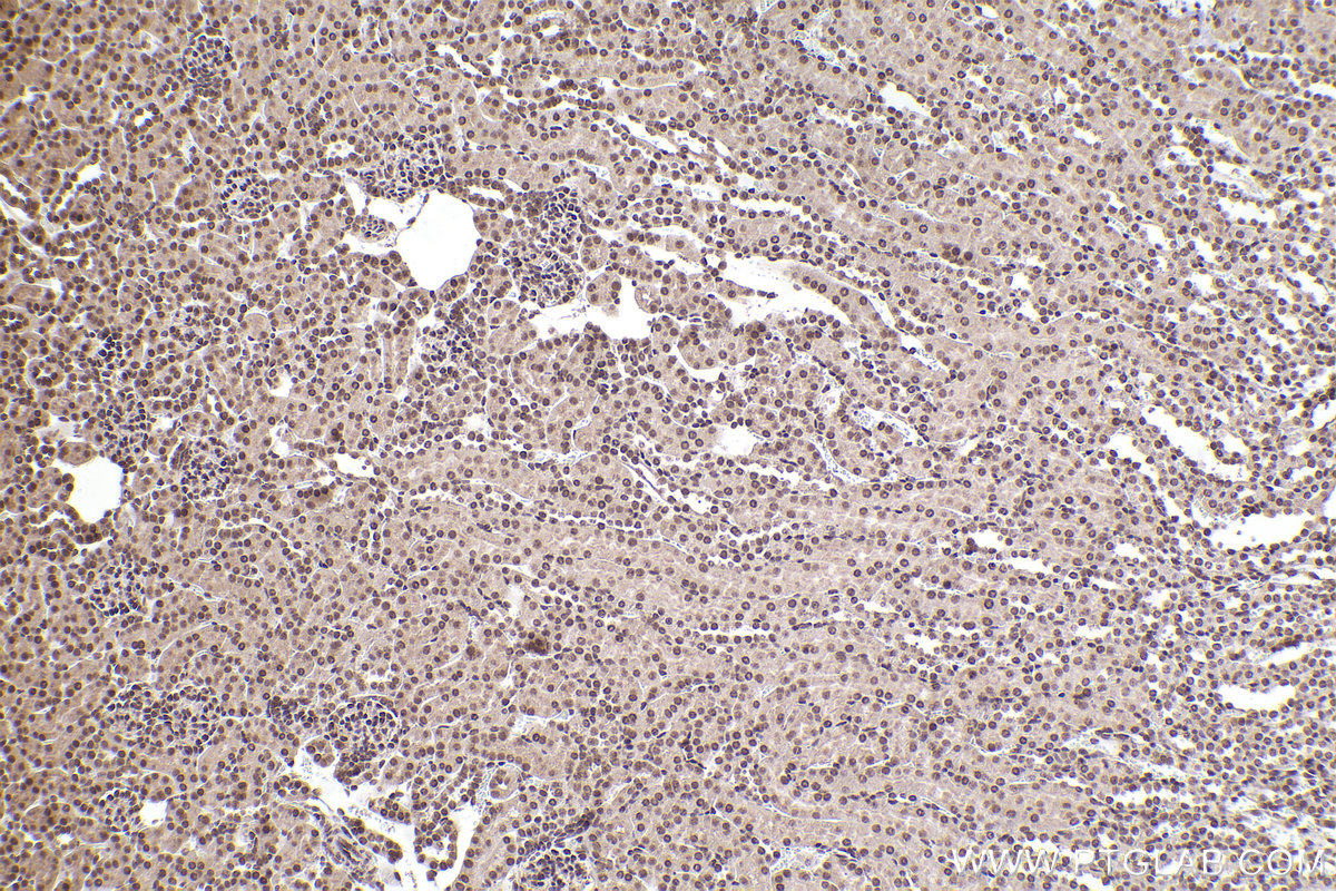 Immunohistochemical analysis of paraffin-embedded mouse kidney tissue slide using KHC2227 (CDC27 IHC Kit).